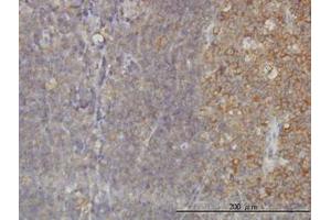 Image no. 1 for anti-RAB21, Member RAS Oncogene Family (RAB21) (AA 116-226) antibody (ABIN599189) (RAB21 anticorps  (AA 116-226))