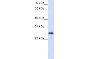 PRDX1 antibody used at 1 ug/ml to detect target protein. (Peroxiredoxin 1 anticorps  (N-Term))