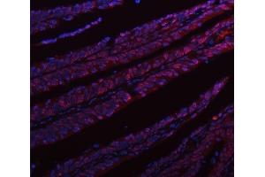 IF analysis of hnRNP L/HNRNPL using anti-hnRNP L/HNRNPL antibody (ABIN7600130). (HNRNPL anticorps  (AA 152-569))