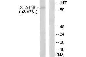 Western blot analysis of extracts from RAW264. (STAT5B anticorps  (pSer731))