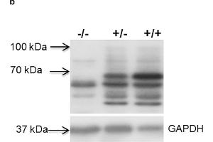 Knockout of the pig GHR gene in F2 homozygous pigs (GHR4bp/4bp refers to -/-). (Growth Hormone Receptor anticorps  (AA 101-200))