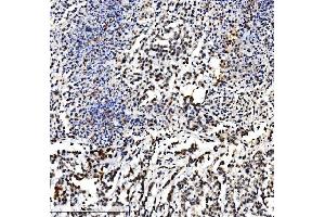 IHC analysis of VPRBP/DCAF1 using anti-VPRBP/DCAF1 antibody (ABIN7599063). (DDB1 and CUL4-Associated Factor 1 (DCAF1) (AA 1-195) anticorps)