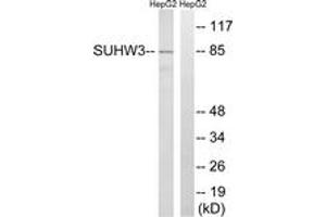 Western blot analysis of extracts from HepG2 cells, using ZNF280C Antibody.