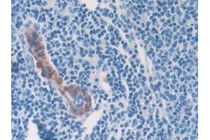 Detection of COL2a1 in Mouse Spleen Tissue using Polyclonal Antibody to Collagen Type II Alpha 1 (COL2a1)