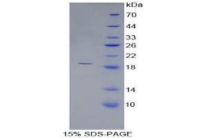 SDS-PAGE (SDS) image for Corin, Serine Peptidase (CORIN) (AA 448-579) protein (His tag) (ABIN2124501) (Corin Protein (AA 448-579) (His tag))