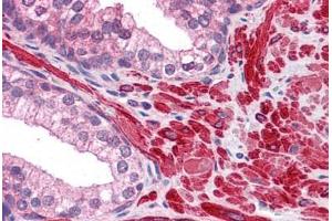 Human Prostate: Formalin-Fixed, Paraffin-Embedded (FFPE) (DPP8 anticorps  (AA 1-39))