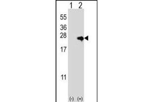 Western blot analysis of NME4 (arrow) using rabbit polyclonal NME4 Antibody (M1) (ABIN392784 and ABIN2842222). (NME4 anticorps  (N-Term))