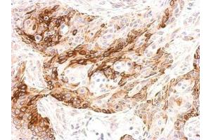 IHC-P Image Galanin Receptor 2 antibody detects GALR2 protein at membrane on Cal27 xenograft by immunohistochemical analysis. (GALR2 anticorps  (C-Term))