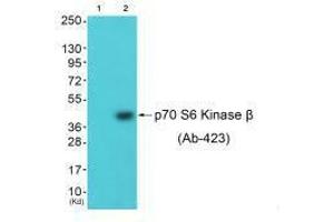 Western blot analysis of extracts from 3T3 cells (Lane 2), using p70 S6 Kinase β (Ab-423) antiobdy. (RPS6KB2 anticorps  (Ser423))