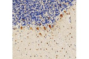 IHC analysis of RPS17 using anti-RPS17 antibody (ABIN7598984). (RPS17 anticorps  (AA 1-135))