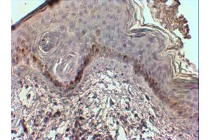 AP31562PU-N (2 µg/ml) staining of paraffin embedded Human Skin. (CMA1 anticorps  (Internal Region))