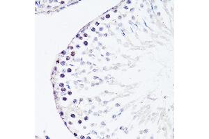 Immunohistochemistry of paraffin-embedded rat testis using FGF12 antibody (ABIN3016419, ABIN3016420, ABIN1679841 and ABIN6219744) at dilution of 1:150 (40x lens).
