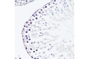 Immunohistochemistry of paraffin-embedded rat testis using FGF12 antibody (ABIN3016419, ABIN3016420, ABIN1679841 and ABIN6219744) at dilution of 1:150 (40x lens). (FGF12 anticorps  (AA 1-181))