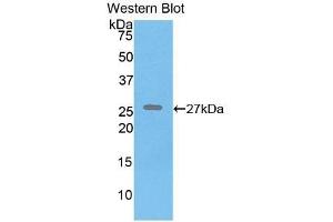 Detection of Recombinant ELN, Human using Polyclonal Antibody to Elastin (ELN) (Elastin anticorps  (AA 392-645))