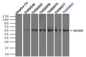 Image no. 3 for anti-Solute Carrier Family 2 (Facilitated Glucose/fructose Transporter), Member 5 (SLC2A5) antibody (ABIN1498472)