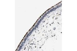 Immunohistochemical staining of human nasopharynx with MTIF2 polyclonal antibody  shows strong membranous positivity in respiratory epithelial cells at 1:20-1:50 dilution.
