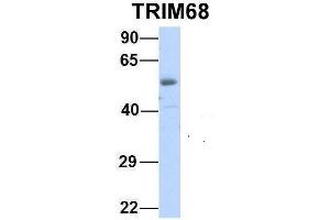 Host:  Rabbit  Target Name:  TRIM68  Sample Type:  Human Fetal Heart  Antibody Dilution:  1. (TRIM68 anticorps  (Middle Region))