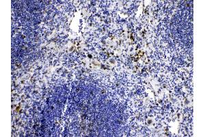 IHC analysis of Caspase8 using anti-Caspase8 antibody .