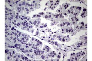 Image no. 16 for anti-Nibrin (NBN) (AA 183-460) antibody (ABIN1491066)