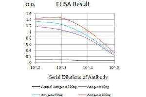 Black line: Control Antigen (100 ng),Purple line: Antigen (10 ng), Blue line: Antigen (50 ng), Red line:Antigen (100 ng)