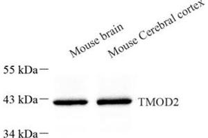 Western blot analysis of TMOD2 (ABIN7076027) at dilution of 1: 500 (TMOD2 anticorps)