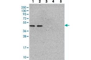 Western blot analysis of Lane 1: RT-4, Lane 2: U-251 MG, Lane 3: Human Plasma, Lane 4: Liver, Lane 5: Tonsil with NSUN6 polyclonal antibody  at 1:250-1:500 dilution. (NSUN6 anticorps)