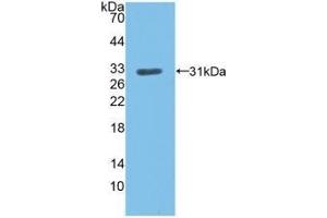 Detection of Recombinant LDLR, Human using Polyclonal Antibody to Low Density Lipoprotein Receptor (LDLR) (LDLR anticorps  (AA 497-742))