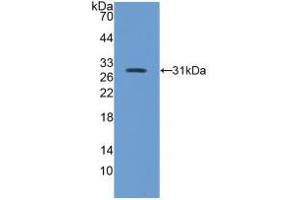 Western blot analysis of recombinant Mouse ITGb5.