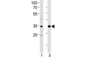ATF4 antibody western blot analysis in (1) Jurkat and (2) MCF-7 lysate