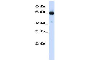 SLC39A4 antibody used at 1 ug/ml to detect target protein. (SLC39A4 anticorps)
