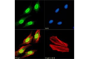 Immunofluorescence staining of fixed HeLa cells with anti-H3K27me3 antibody BT164.