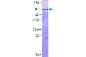 Image no. 1 for F-Box and Leucine-Rich Repeat Protein 17 (FBXL17) (AA 1-369) protein (GST tag) (ABIN1353729)