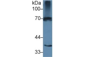 Detection of IL1R1 in Rat Spleen lysate using Polyclonal Antibody to Interleukin 1 Receptor Type I (IL1R1)