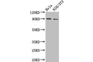 Western Blot Positive WB detected in: Hela whole cell lysate, NIH/3T3 whole cell lysate All lanes: L1CAM antibody at 2 μg/mL Secondary Goat polyclonal to rabbit IgG at 1/50000 dilution Predicted band size: 141, 140, 139 kDa Observed band size: 90 kDa (L1CAM anticorps  (AA 995-1119))