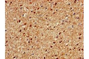 Immunohistochemistry of paraffin-embedded human brain tissue using ABIN7166170 at dilution of 1:100