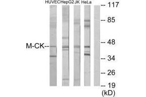 Western blot analysis of extracts from HUVEC cells, HepG2 cells, Jurkat cells and HeLa cells, using M-CK antibody. (CKM anticorps  (N-Term))