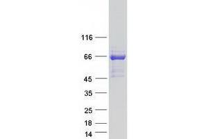 Validation with Western Blot