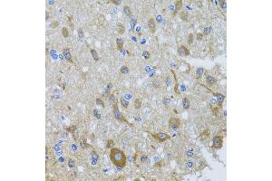 Immunohistochemistry of paraffin-embedded rat brain using DYNC1I1 antibody at dilution of 1:100 (x40 lens). (DYNC1I1 anticorps)