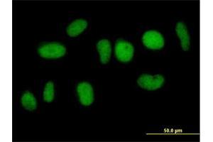 Immunofluorescence of purified MaxPab antibody to NFATC2IP on HeLa cell. (NFATC2IP anticorps  (AA 1-138))
