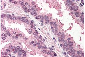 Human Prostate (formalin-fixed, paraffin-embedded) stained with RAD23A antibody ABIN290446 at 5 ug/ml followed by biotinylated anti-goat IgG secondary antibody ABIN481715, alkaline phosphatase-streptavidin and chromogen. (RAD23A anticorps  (AA 122-135))