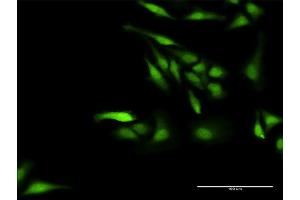 Immunofluorescence of purified MaxPab antibody to NPLOC4 on HeLa cell. (NPLOC4 anticorps  (AA 1-608))