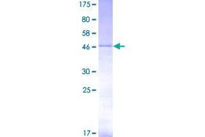 Image no. 1 for Twist Homolog 1 (Drosophila) (TWIST1) (AA 1-202) protein (GST tag) (ABIN1324198)