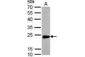 WB Image Transgelin antibody detects TAGLN protein by Western blot analysis.