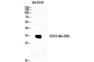 Western Blotting (WB) image for anti-Fc gamma RII (CD32) (Ser376) antibody (ABIN3183763) (Fc gamma RII (CD32) (Ser376) anticorps)
