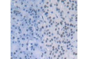 IHC-P analysis of Human Tissue, with DAB staining. (CPSF1 anticorps  (AA 1-300))