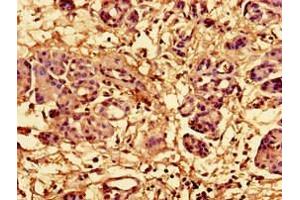 Immunohistochemistry of paraffin-embedded human pancreatic tissue using ABIN7142792 at dilution of 1:100 (RPL28 anticorps  (AA 2-137))