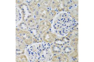 Immunohistochemistry of paraffin-embedded rat kidney using TUBB8 antibody.