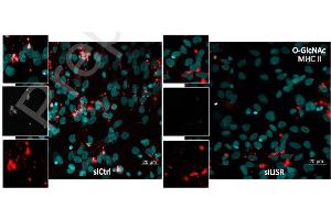 Co-staining for the MHCII (Red) and O-GlcNac (grey) revealed an overlap between the glycosylation signal and the antigen presenting machinery.