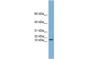 WB Suggested Anti-HRK Antibody Titration:  0.