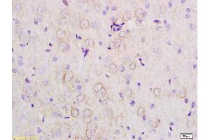 Formalin-fixed and paraffin embedded rat brain tissue labeled with Anti-APOE3 Polyclonal Antibody, Unconjugated (ABIN708761) at 1:200 followed by conjugation to the secondary antibody